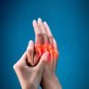 arthritis (1)